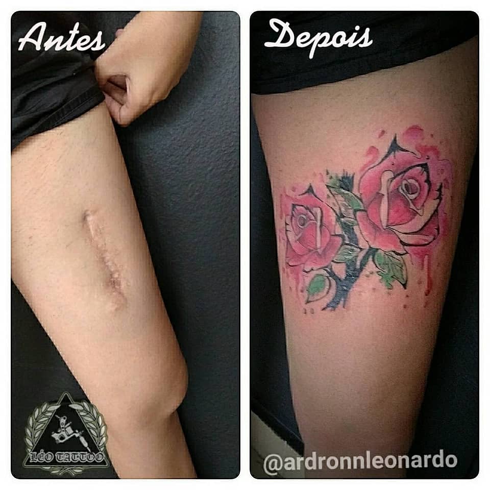 Watercolor Rose Scar Cover-Up